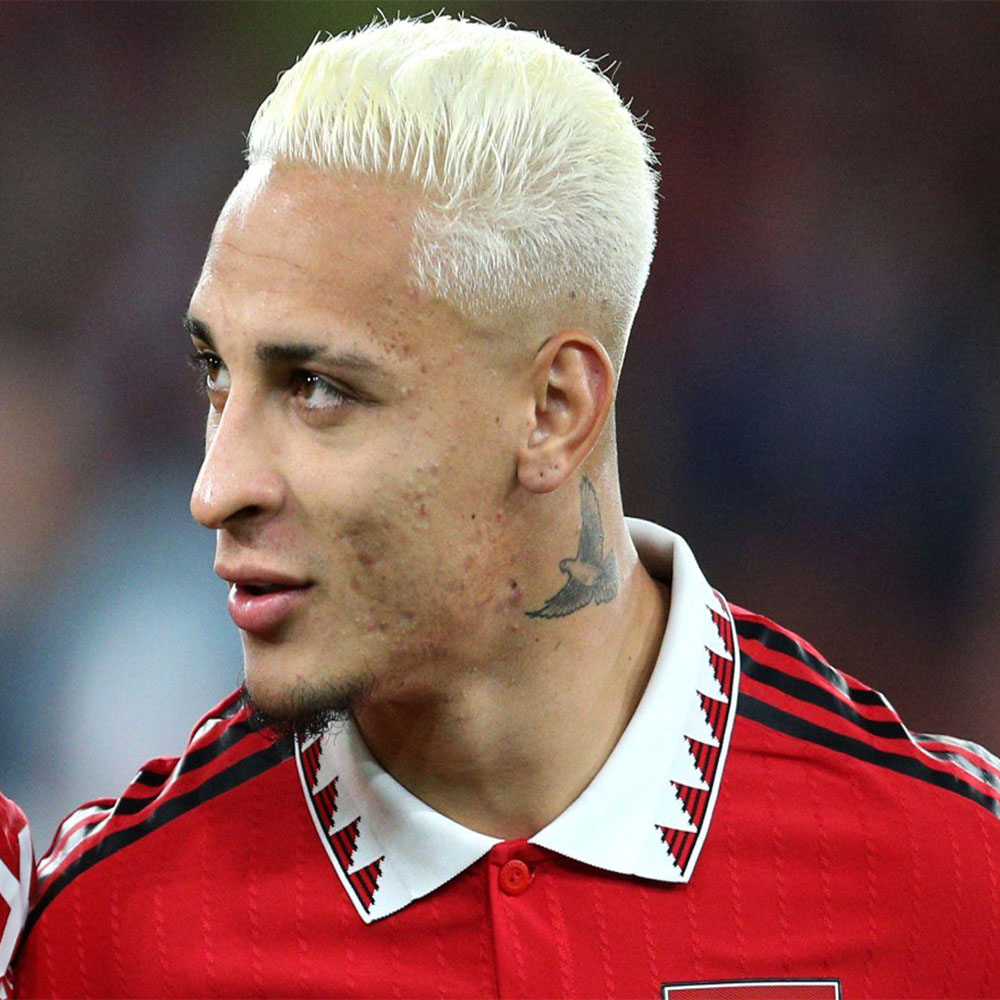 آنتونی ماتئوس - عکس های فوتبالی آنتونی ماتئوس