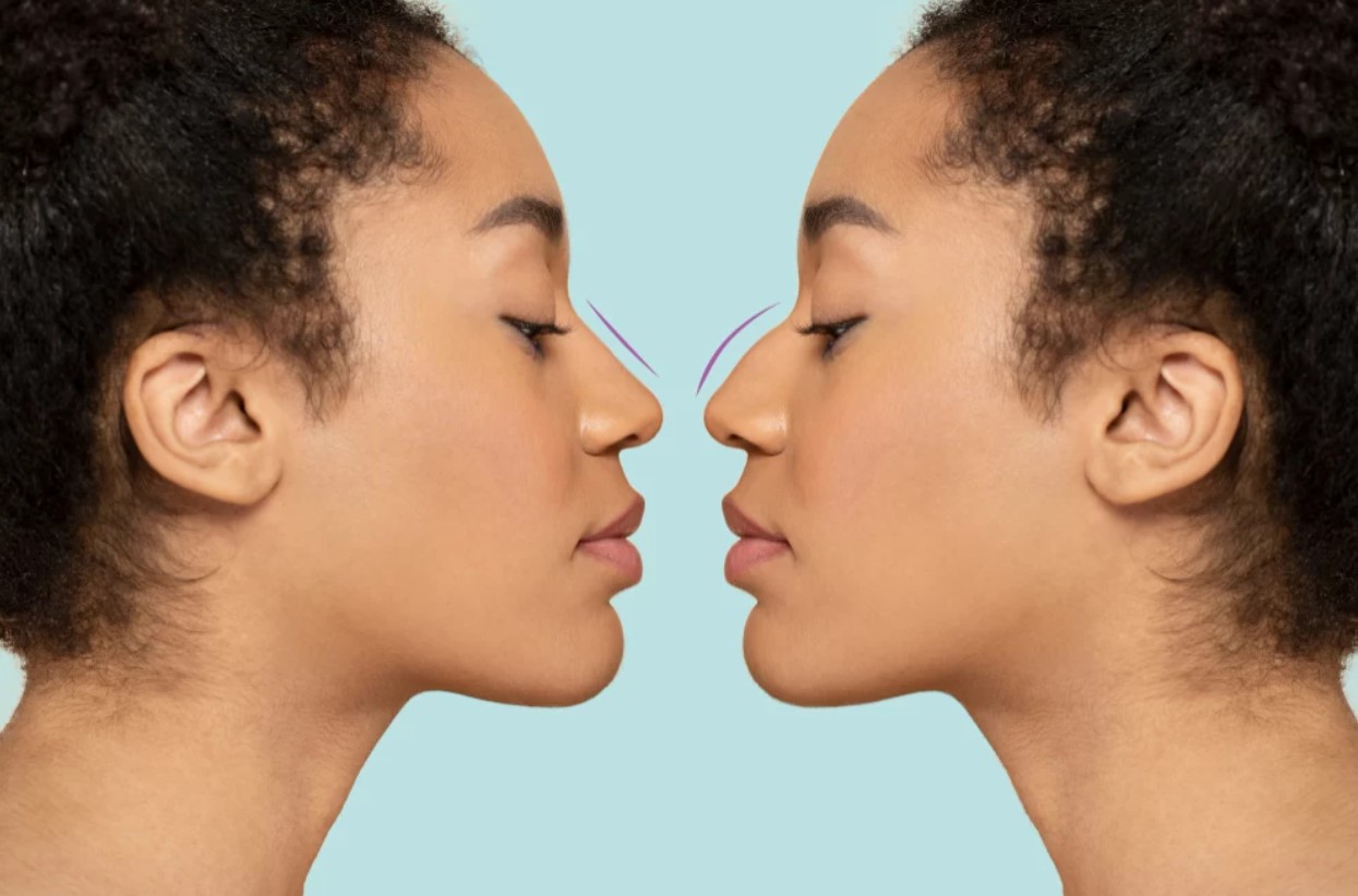 عکس ترند 2026 بینی