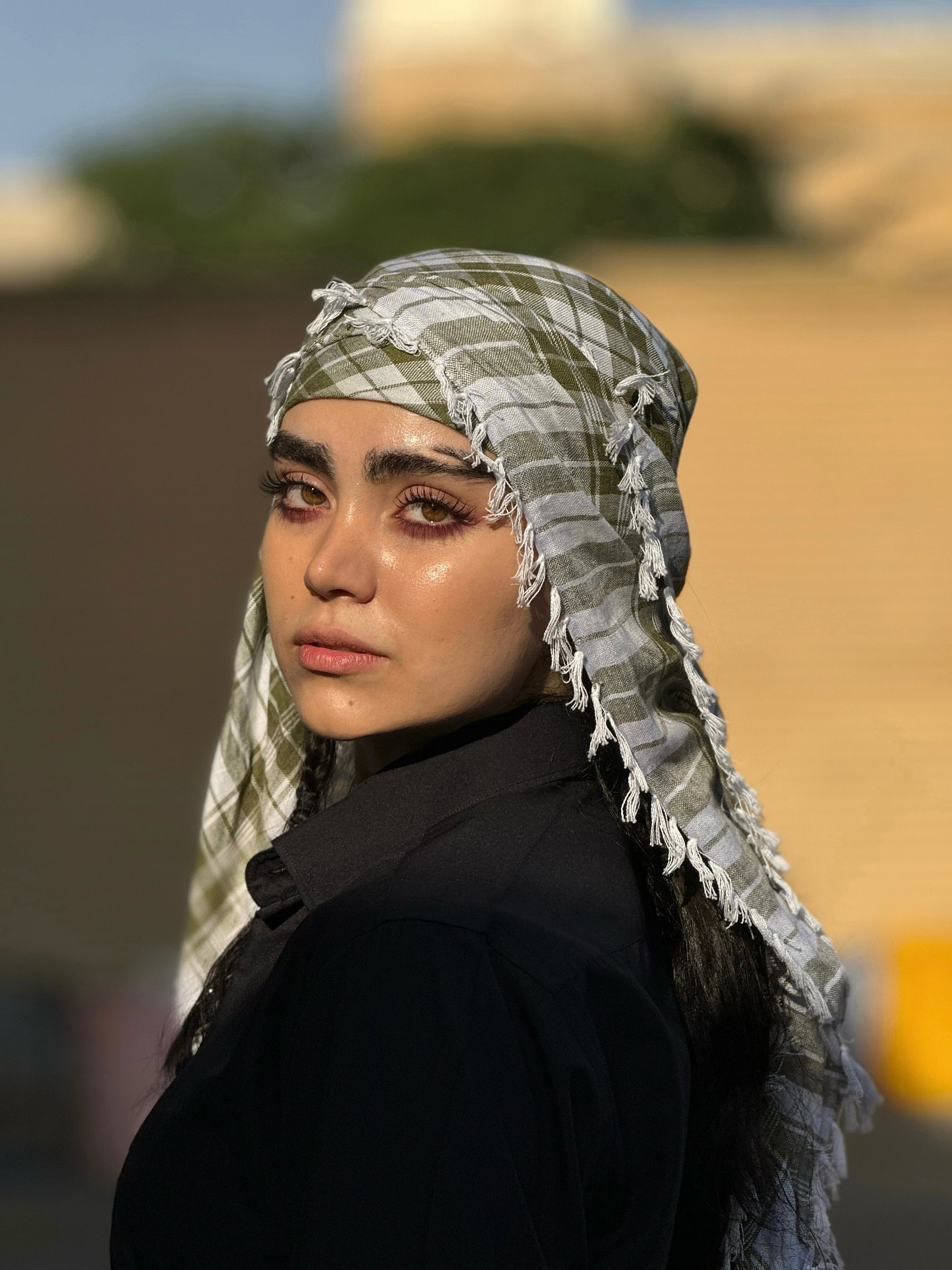 محیا امیدبیگی قبل از عمل بینی